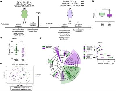 A specific tongue microbiota signature is found in patients displaying an improvement of orosensory lipid perception after a sleeve gastrectomy